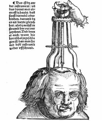 trepanation